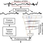 Neonatal seizure detection from raw multi-channel EEG using fully convolutional architecture